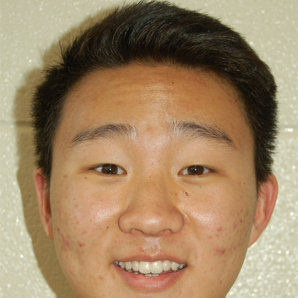 Matthew Song mugshot