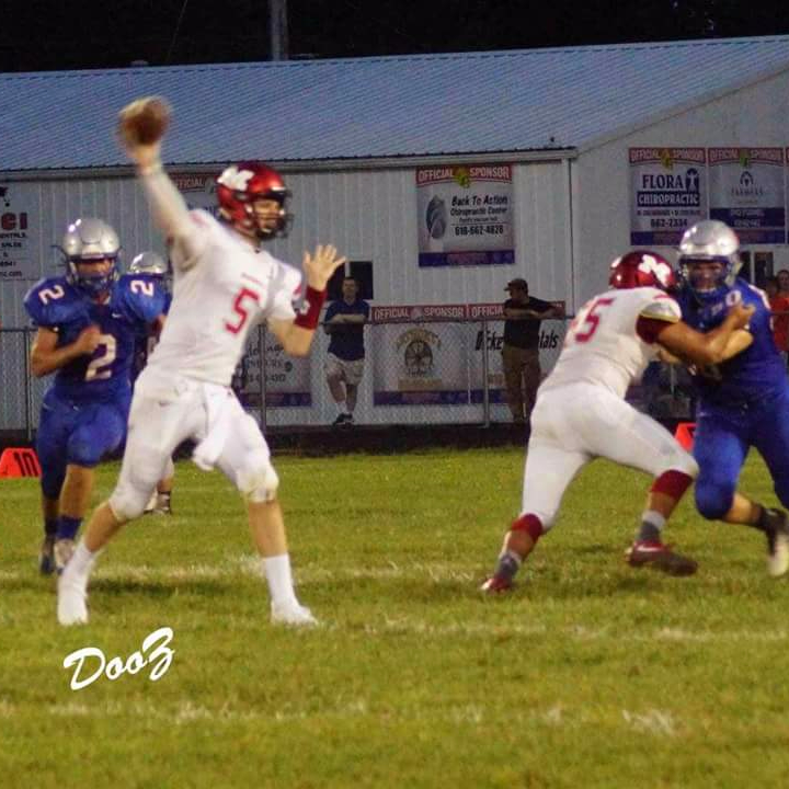 Marcus Downs