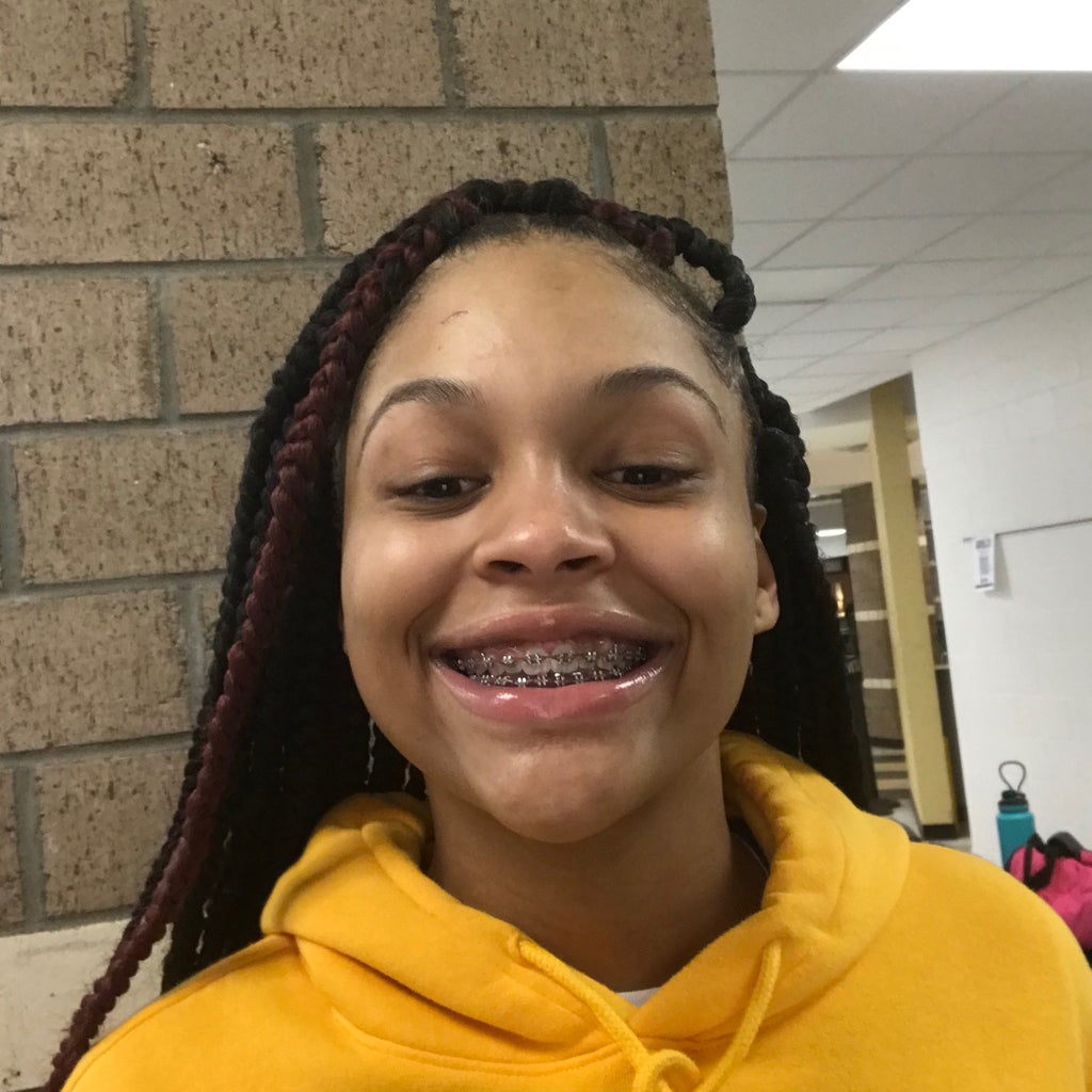Jolai Allen