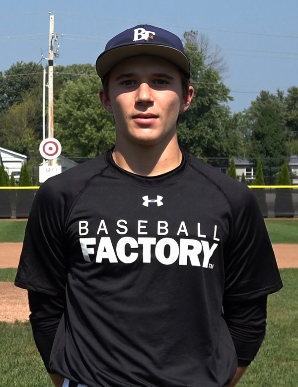 Zach McKenna