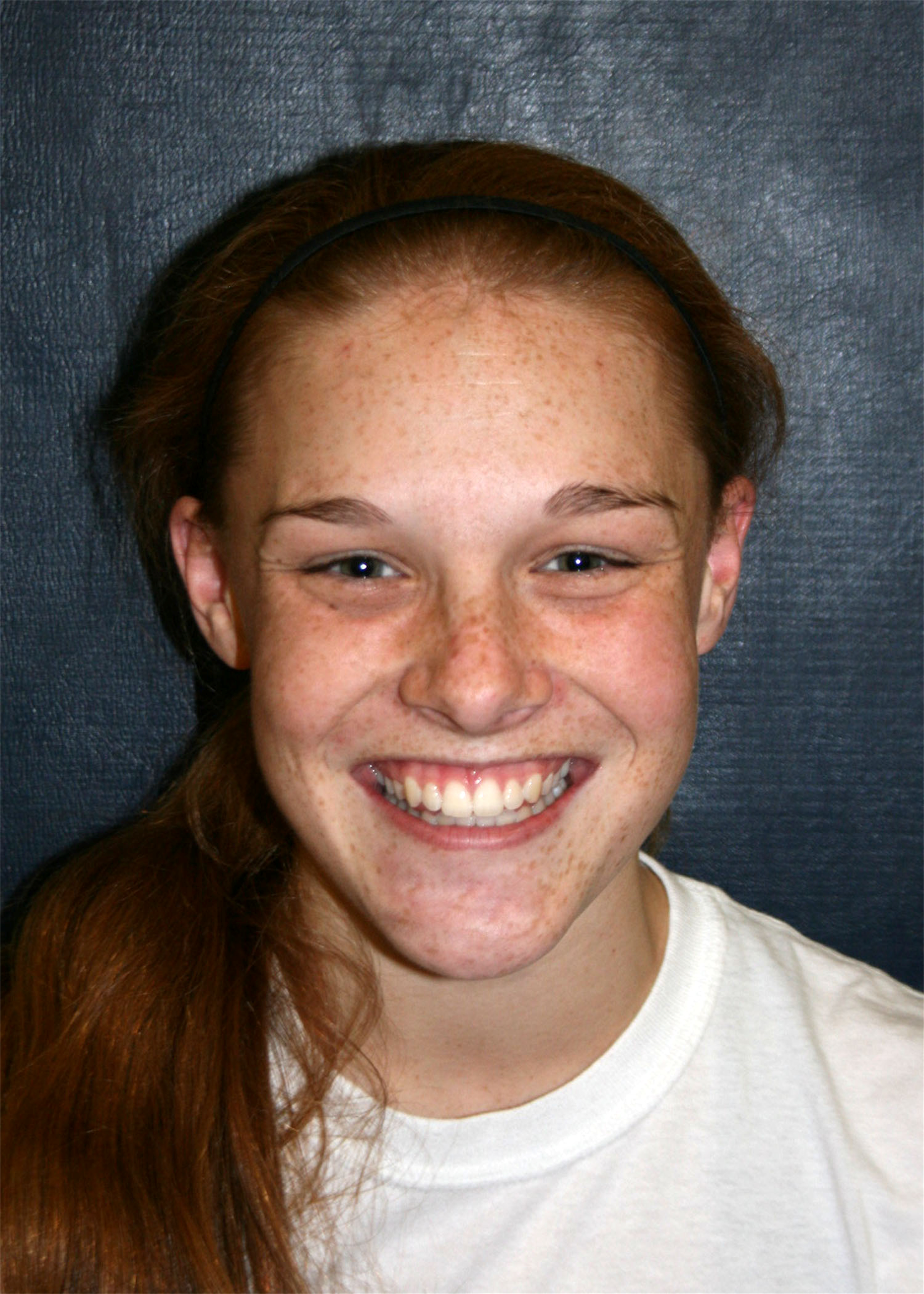 Sydnie Martindale