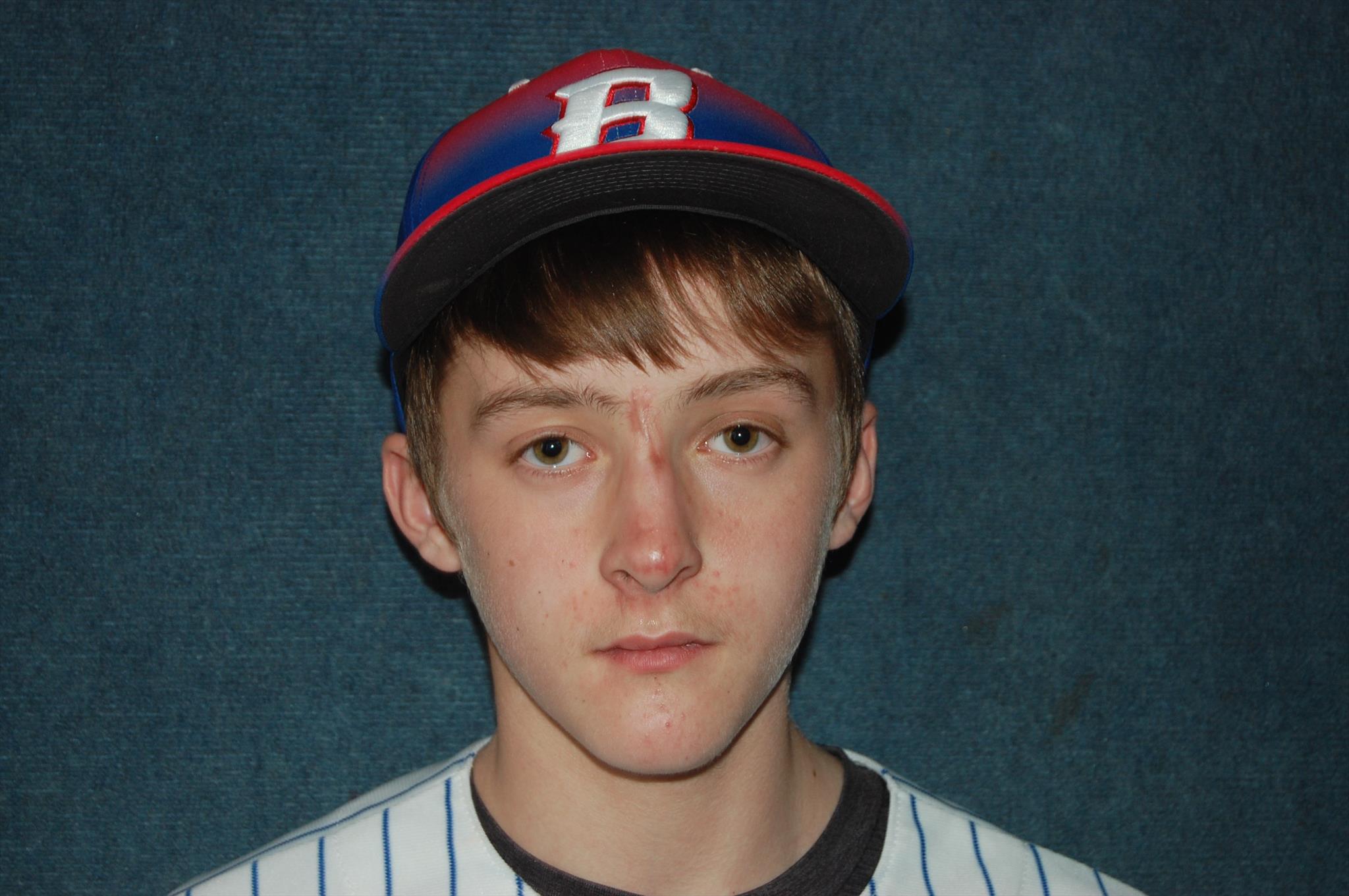 Braden Krise