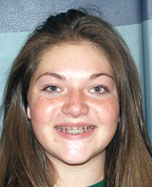 Molly Gallagher